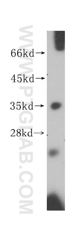 Western Blot (WB) analysis of human plasma using HLA-DRB4 Polyclonal antibody (15733-1-AP)