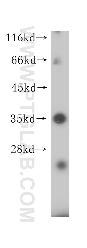 Western Blot (WB) analysis of Jurkat cells using HLA-DRB4 Polyclonal antibody (15733-1-AP)