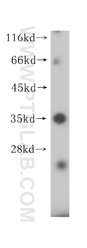 WB analysis of Jurkat using 15733-1-AP