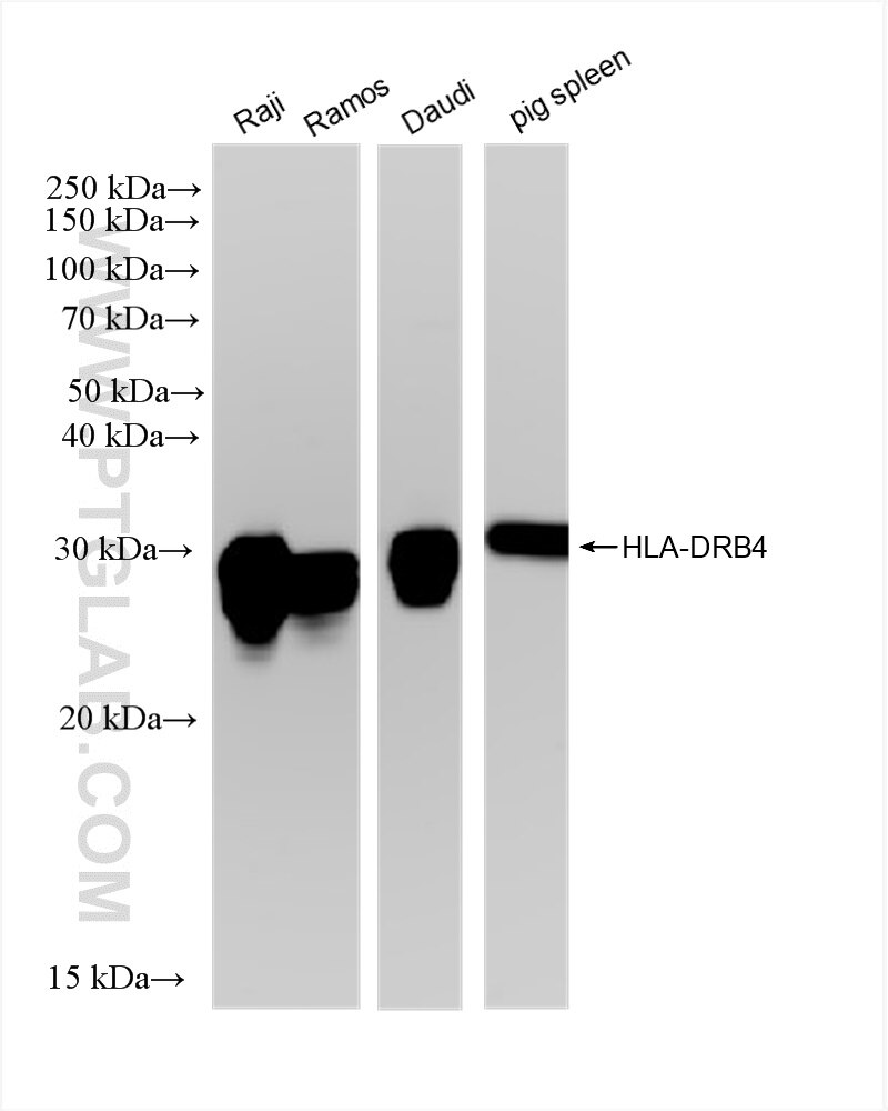 Western Blot (WB) analysis of various lysates using HLA-DRB4 Recombinant antibody (83103-1-RR)