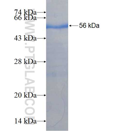 HLA-DRB4 fusion protein Ag8492 SDS-PAGE