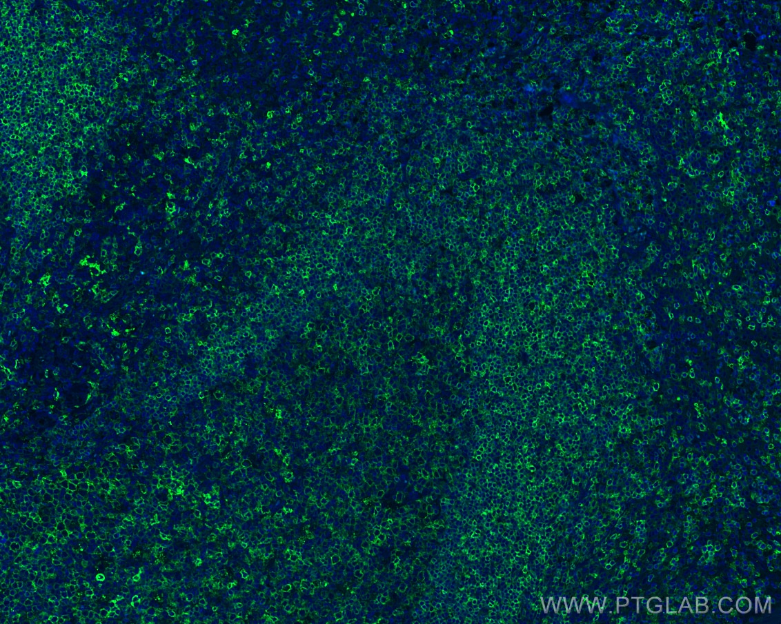 Immunofluorescence (IF) / fluorescent staining of human tonsillitis tissue using HLA-DRB5 Polyclonal antibody (21702-1-AP)