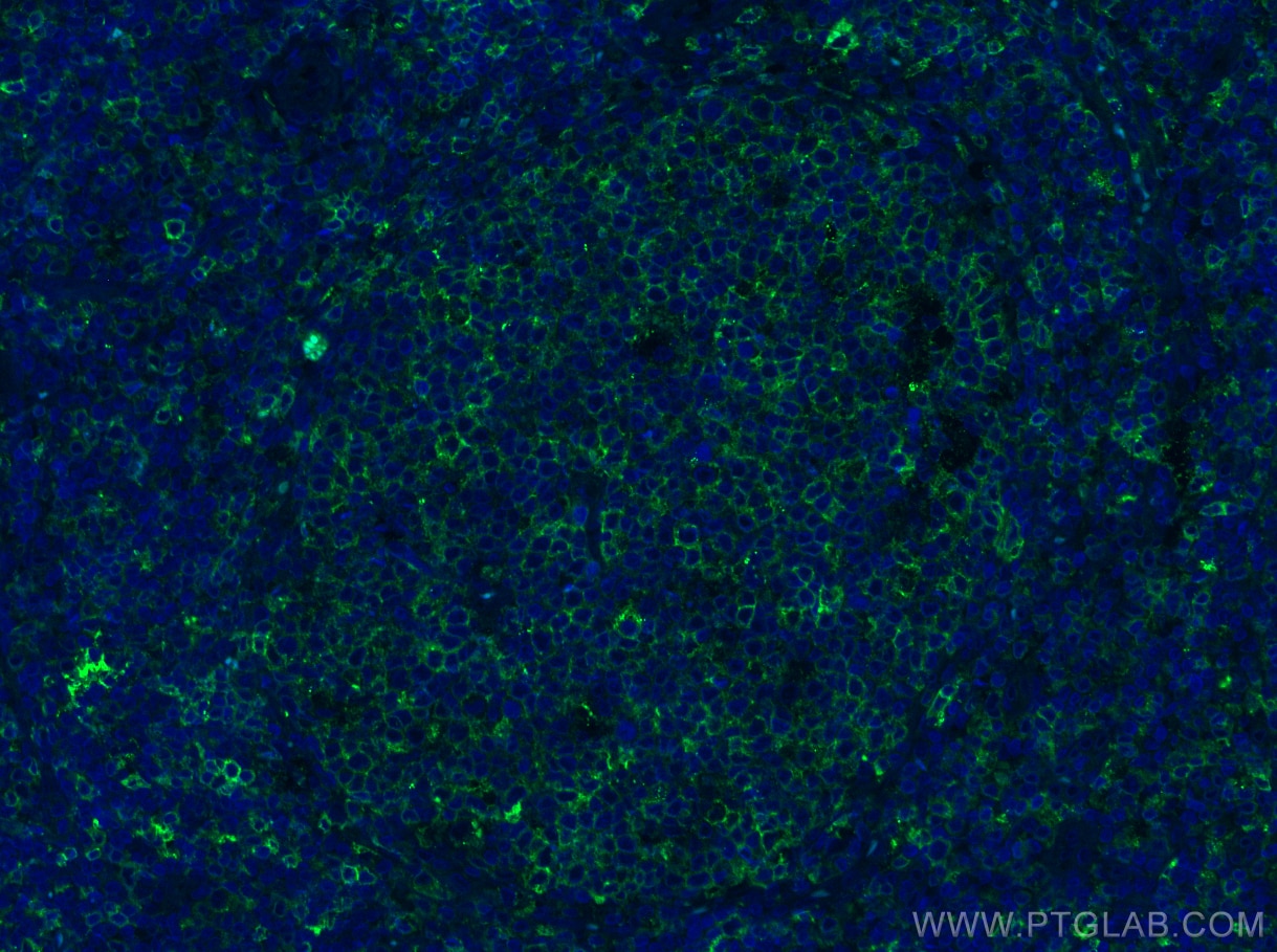 Immunofluorescence (IF) / fluorescent staining of human tonsillitis tissue using HLA-DRB5 Polyclonal antibody (21702-1-AP)