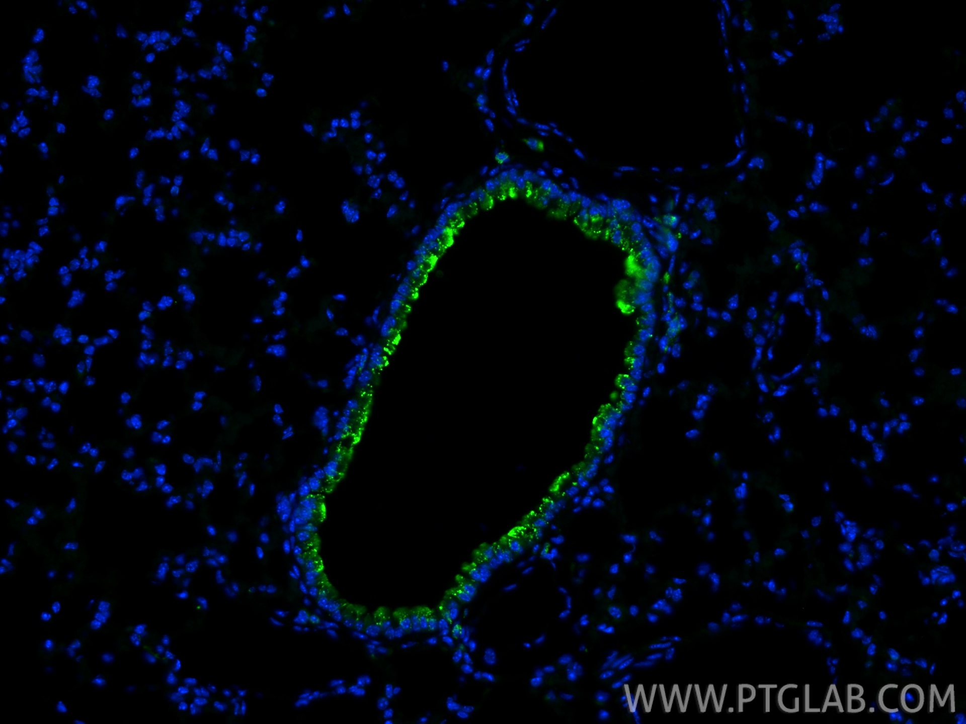 Immunofluorescence (IF) / fluorescent staining of mouse lung tissue using HLA-DRB5 Polyclonal antibody (21702-1-AP)