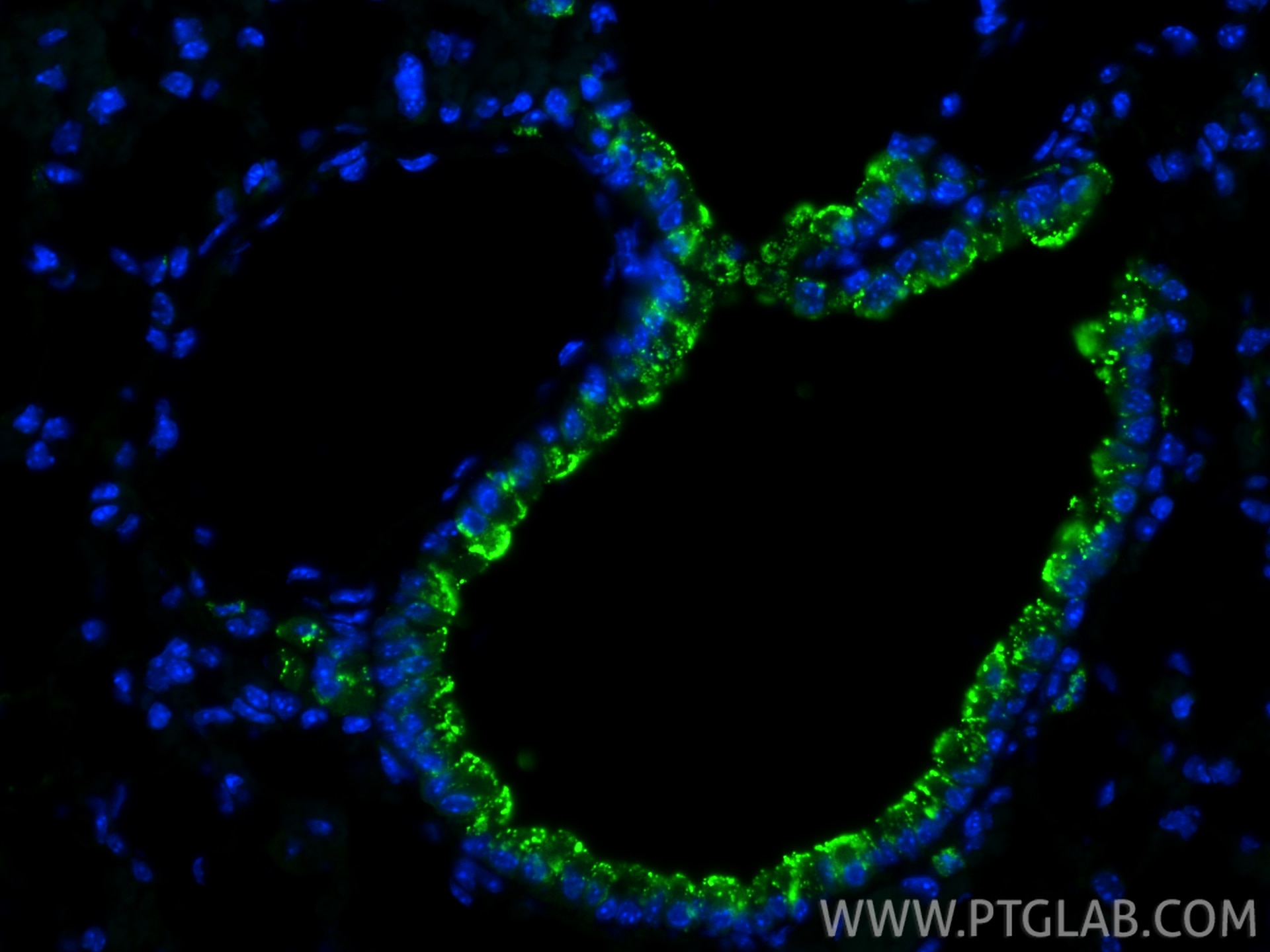 Immunofluorescence (IF) / fluorescent staining of mouse lung tissue using HLA-DRB5 Polyclonal antibody (21702-1-AP)