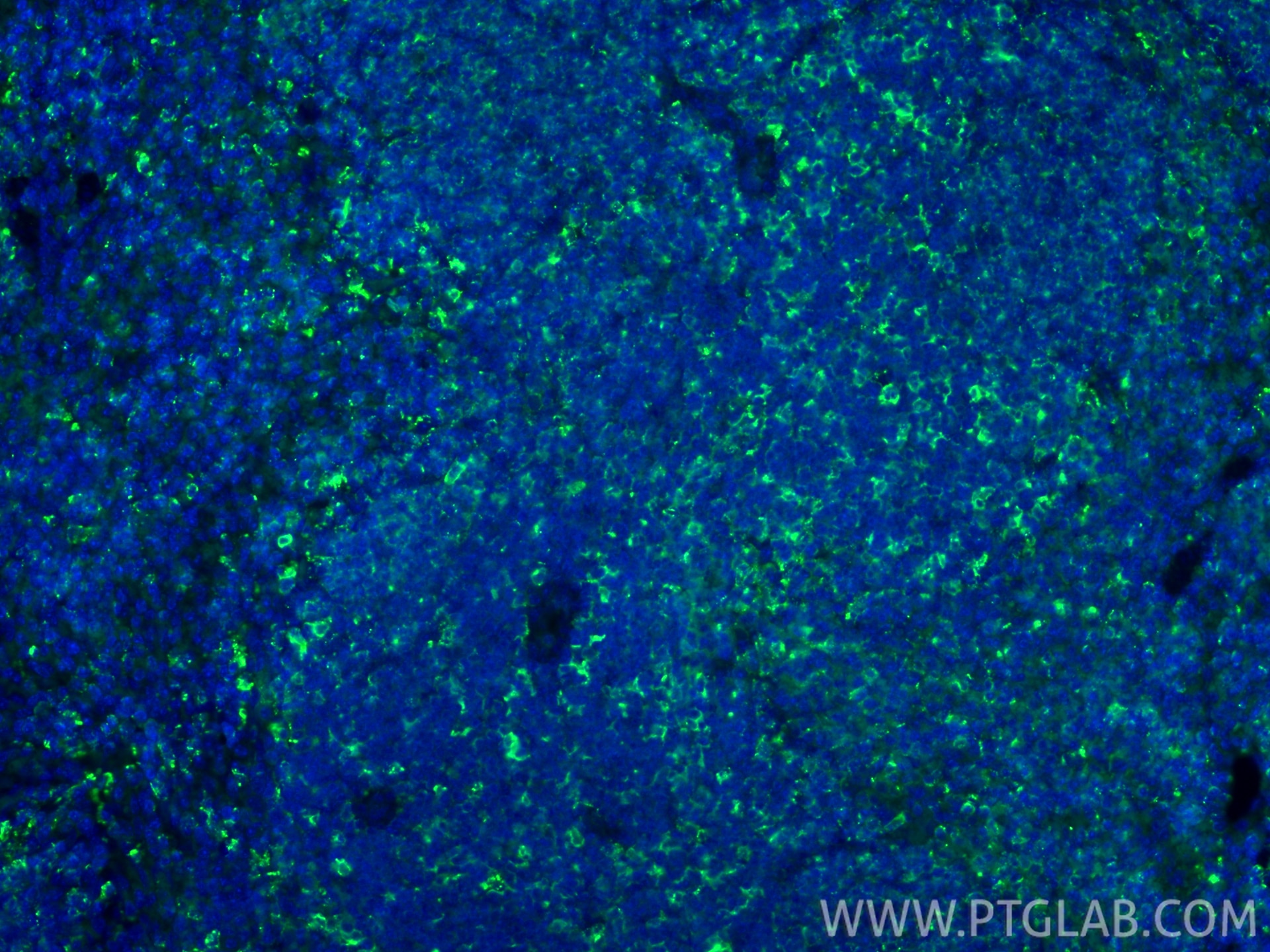 IF Staining of mouse spleen using 21702-1-AP Immunofluorescence (IF) / fluorescent staining of mouse spleen tissue using HLA-DRB5 Polyclonal antibody (21702-1-AP)