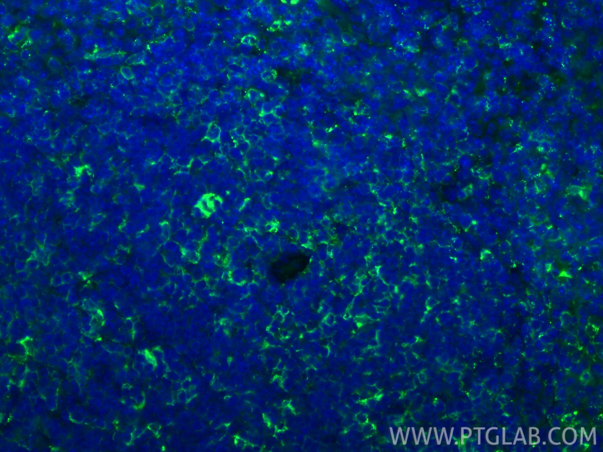 Immunofluorescence (IF) / fluorescent staining of mouse spleen tissue using HLA-DRB5 Polyclonal antibody (21702-1-AP)