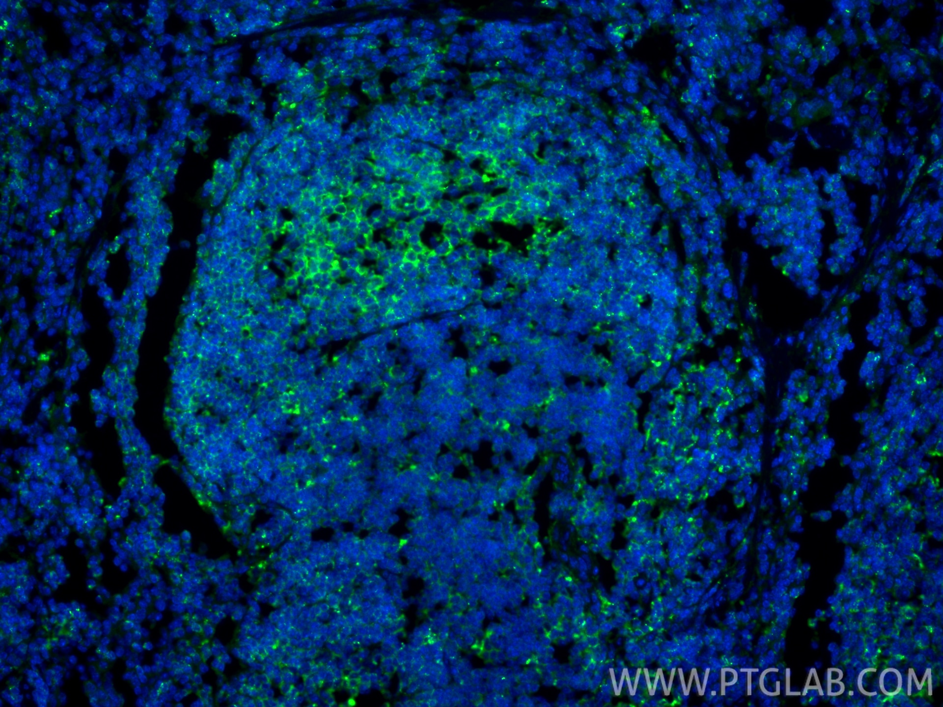 Immunofluorescence (IF) / fluorescent staining of mouse spleen tissue using HLA-DRB5 Polyclonal antibody (21702-1-AP)