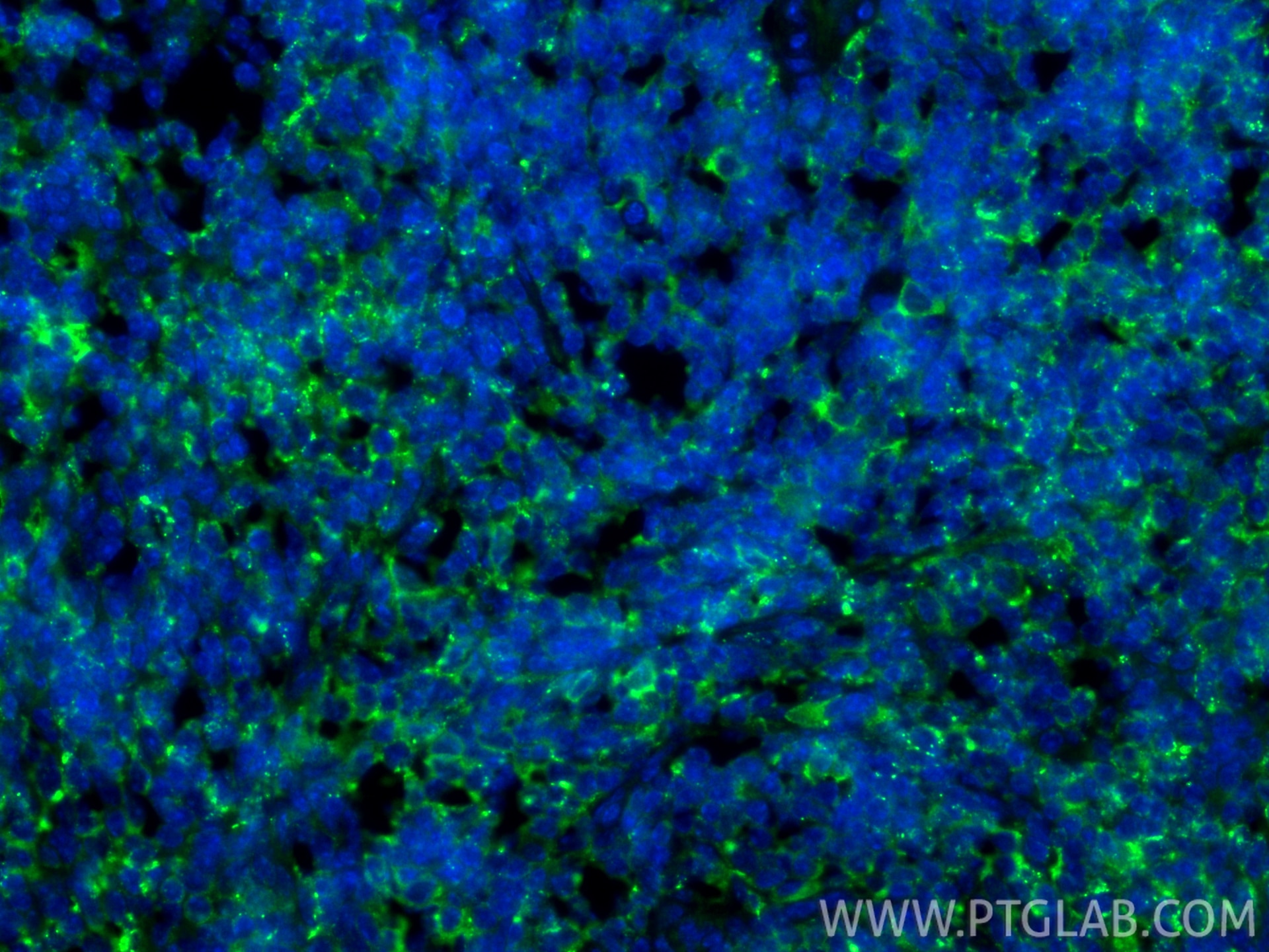 Immunofluorescence (IF) / fluorescent staining of mouse spleen tissue using HLA-DRB5 Polyclonal antibody (21702-1-AP)