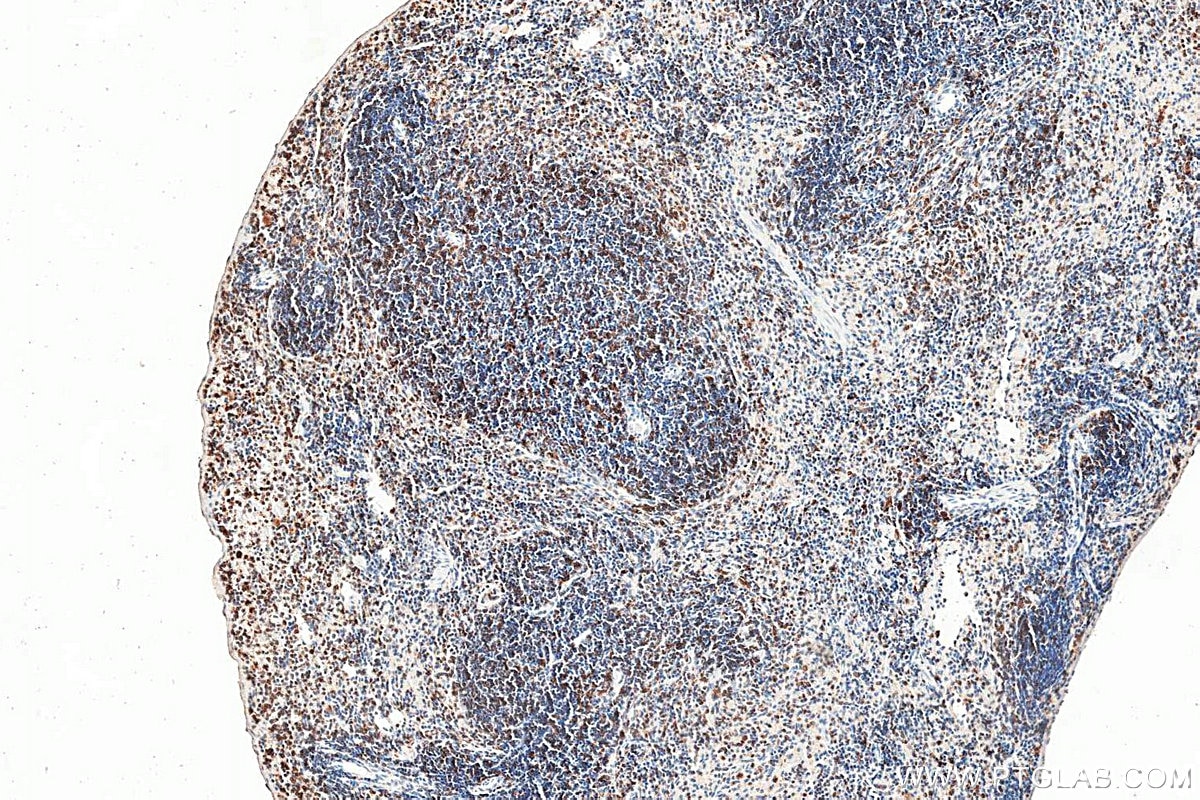 IHC staining of mouse spleen using 21702-1-AP Immunohistochemistry (IHC) staining of mouse spleen tissue using HLA-DRB5 Polyclonal antibody (21702-1-AP)