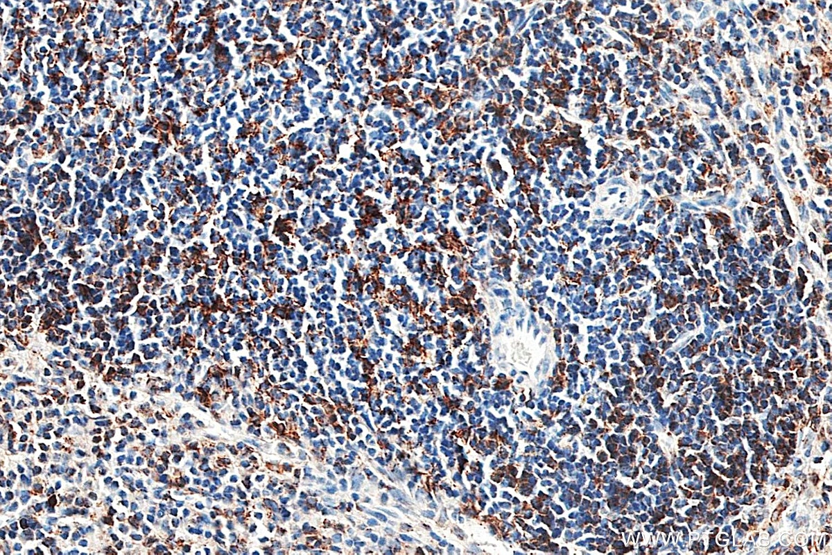 IHC staining of mouse spleen using 21702-1-AP Immunohistochemistry (IHC) staining of mouse spleen tissue using HLA-DRB5 Polyclonal antibody (21702-1-AP)