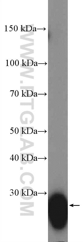 Western Blot (WB) analysis of Raji cells using HLA-DRB5 Polyclonal antibody (21702-1-AP)