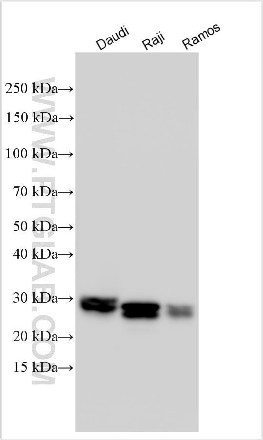 Western Blot (WB) analysis of various lysates using HLA-DRB5 Polyclonal antibody (21702-1-AP)