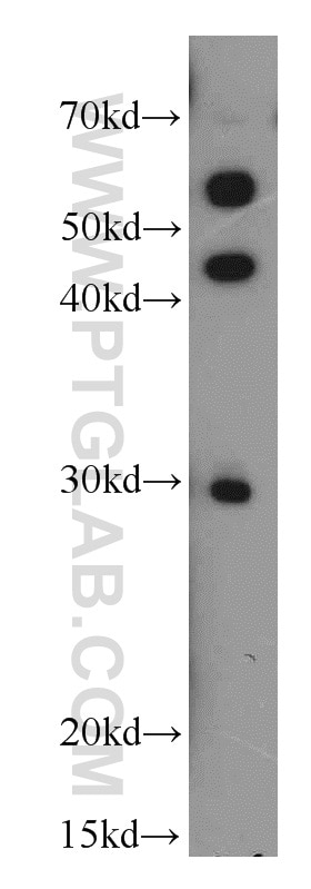 Western Blot (WB) analysis of HeLa cells using HLA-DRB5 Polyclonal antibody (21702-1-AP)