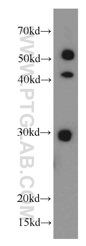 Western Blot (WB) analysis of HL-60 cells using HLA-DRB5 Polyclonal antibody (21702-1-AP)