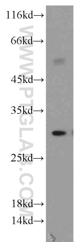 Western Blot (WB) analysis of HepG2 cells using HLA-DRB5 Polyclonal antibody (21702-1-AP)