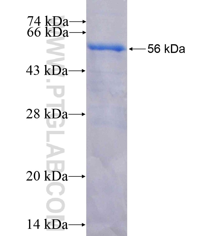 HLA-DRB5 fusion protein Ag16307 SDS-PAGE