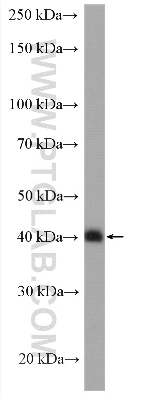 Western Blot (WB) analysis of HUVEC cells using HLA-E Polyclonal antibody (15008-1-AP)