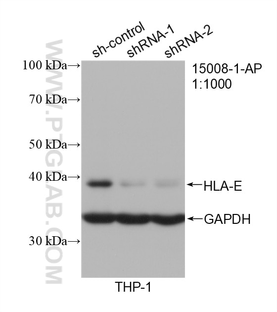Western Blot (WB) analysis of THP-1 cells using HLA-E Polyclonal antibody (15008-1-AP)