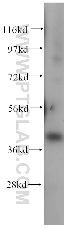 Western Blot (WB) analysis of human kidney tissue using HLA-E Polyclonal antibody (15008-1-AP)