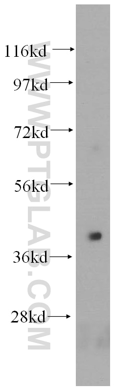 Western Blot (WB) analysis of human liver tissue using HLA-E Polyclonal antibody (15008-1-AP)