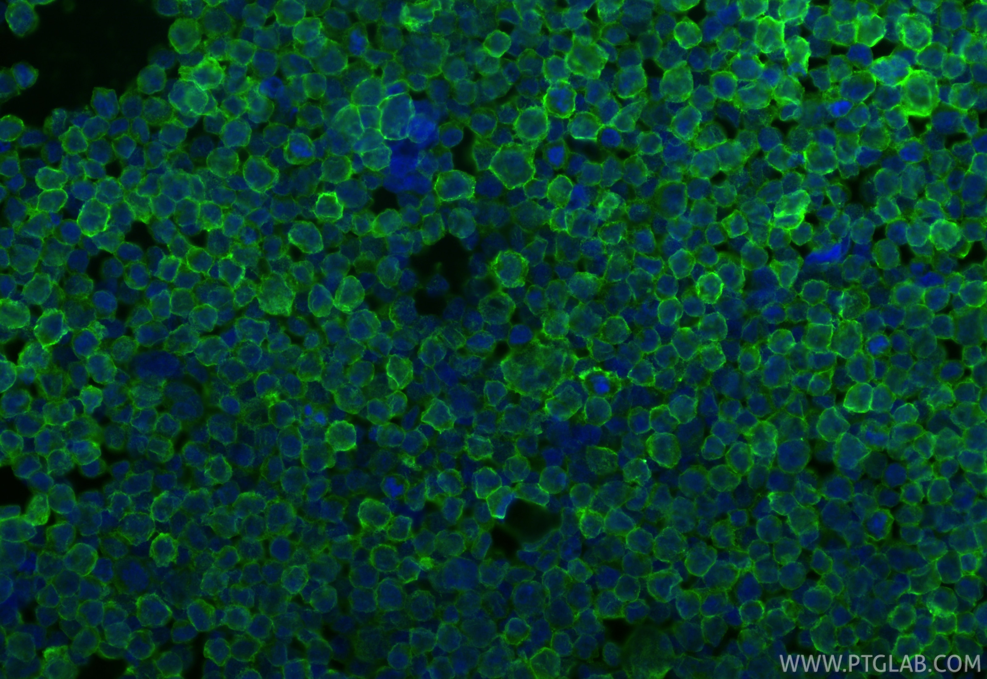Immunofluorescence (IF) / fluorescent staining of Raji cells using HLA-E Polyclonal antibody (27411-1-AP)