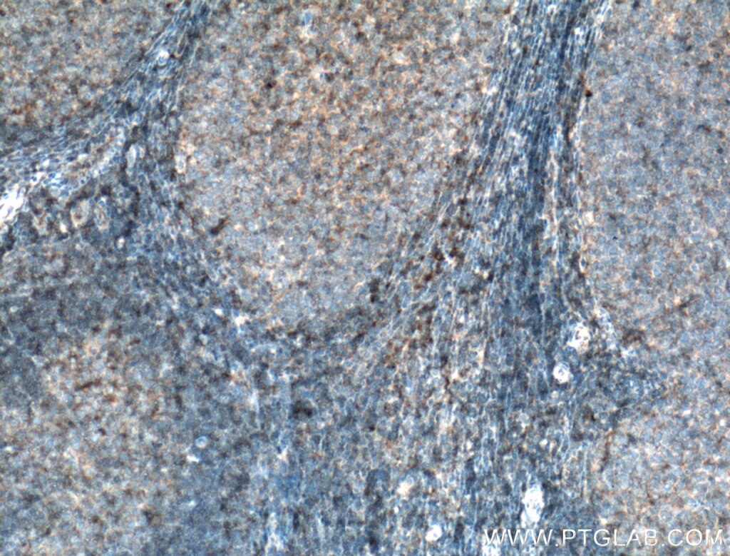 Immunohistochemistry (IHC) staining of human tonsillitis tissue using HLA-E Polyclonal antibody (27411-1-AP)