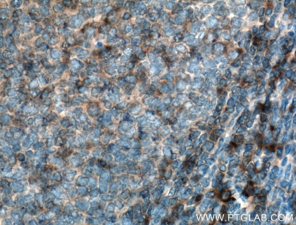 Immunohistochemistry (IHC) staining of human tonsillitis tissue using HLA-E Polyclonal antibody (27411-1-AP)