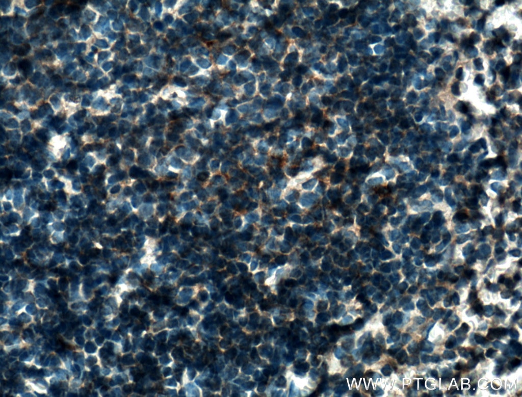 Immunohistochemistry (IHC) staining of mouse spleen tissue using HLA-E Polyclonal antibody (27411-1-AP)