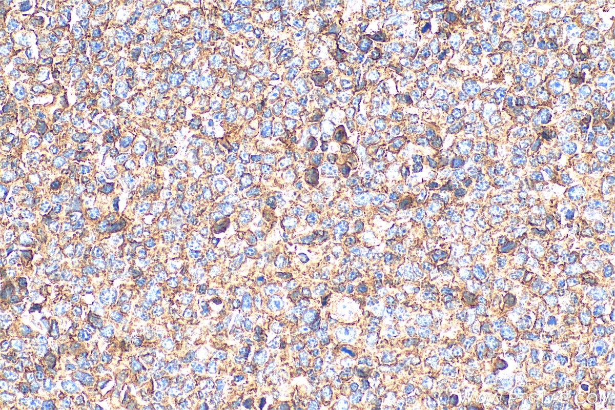 Immunohistochemistry (IHC) staining of human tonsillitis tissue using HLA-E Polyclonal antibody (27411-1-AP)