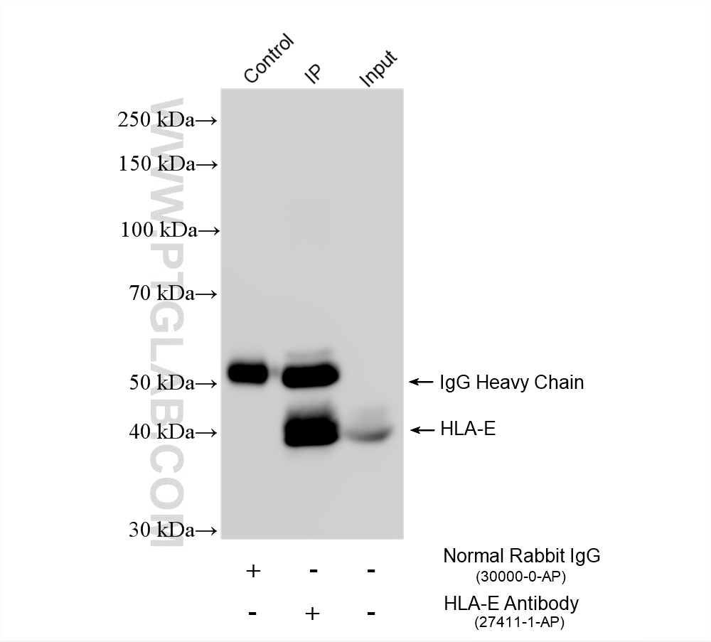 Immunoprecipitation (IP) experiment of THP-1 cells using HLA-E Polyclonal antibody (27411-1-AP)