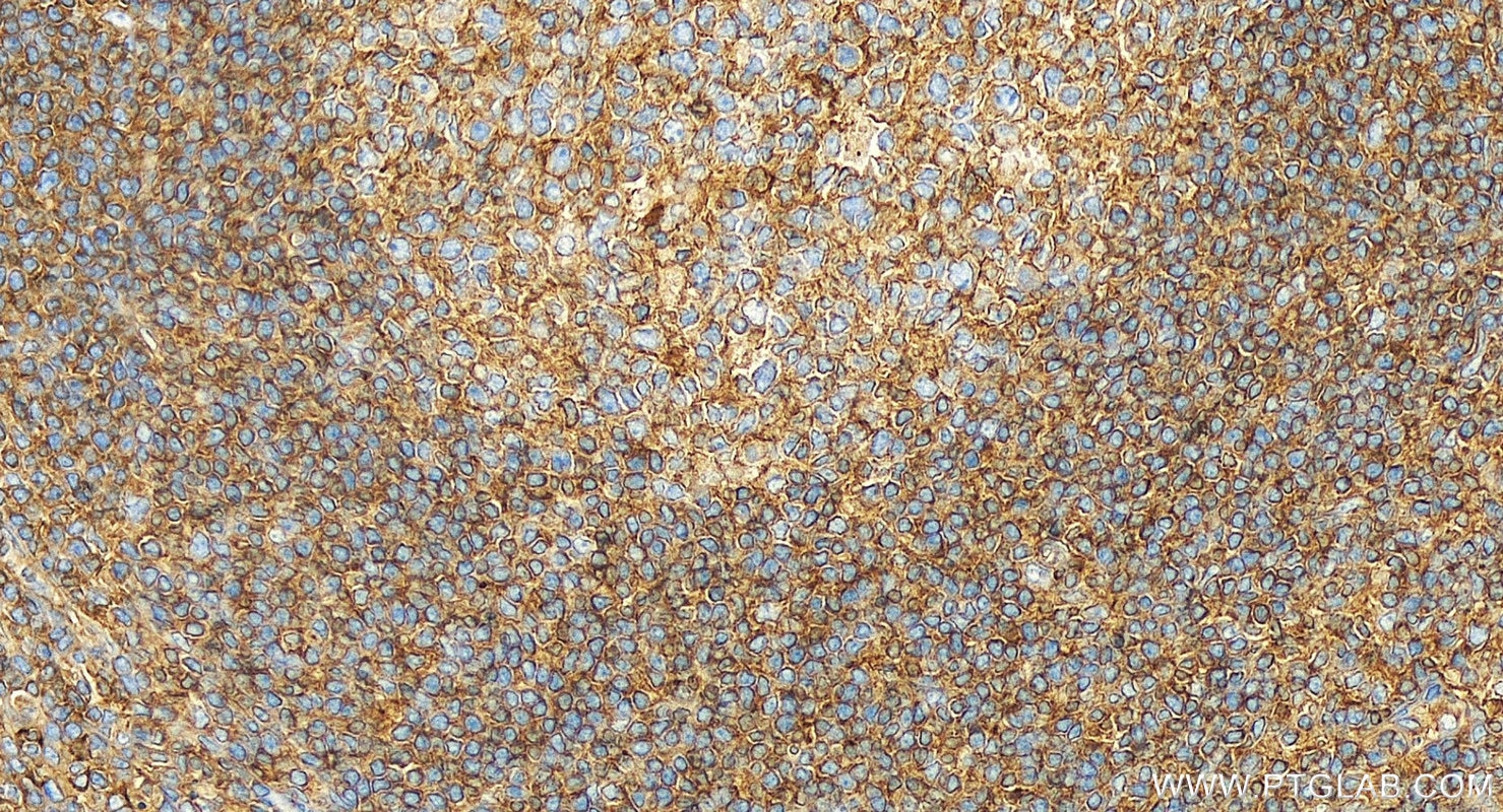Immunohistochemistry (IHC) staining of human tonsillitis tissue using HLA-E Polyclonal antibody (27411-1-AP)