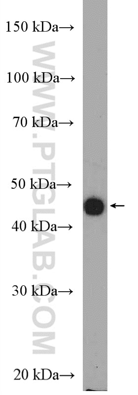 Western Blot (WB) analysis of HL-60 cells using HLA-E Polyclonal antibody (27411-1-AP)