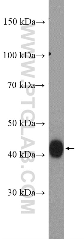 Western Blot (WB) analysis of human placenta tissue using HLA-E Polyclonal antibody (27411-1-AP)
