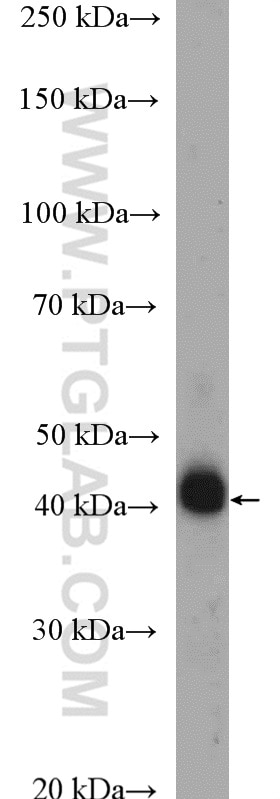 Western Blot (WB) analysis of U-937 cells using HLA-E Polyclonal antibody (27411-1-AP)