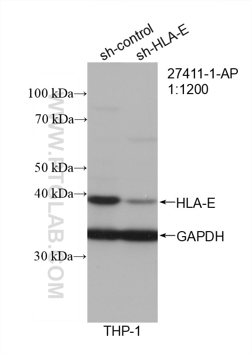 Western Blot (WB) analysis of THP-1 cells using HLA-E Polyclonal antibody (27411-1-AP)