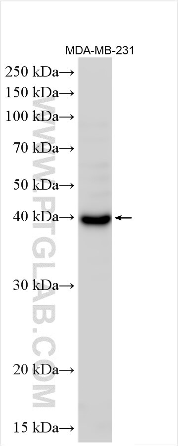 Western Blot (WB) analysis of various lysates using HLA-E Polyclonal antibody (27411-1-AP)