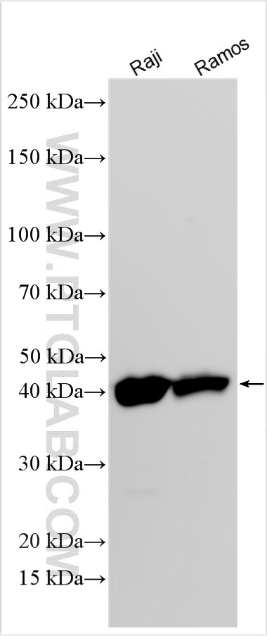 Western Blot (WB) analysis of various lysates using HLA-E Polyclonal antibody (27411-1-AP)