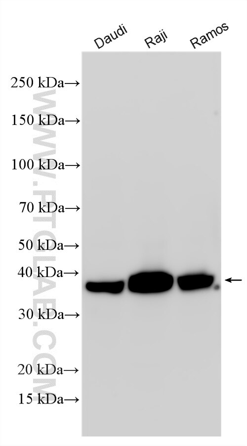 Western Blot (WB) analysis of various lysates using HLA-E Polyclonal antibody (27411-1-AP)