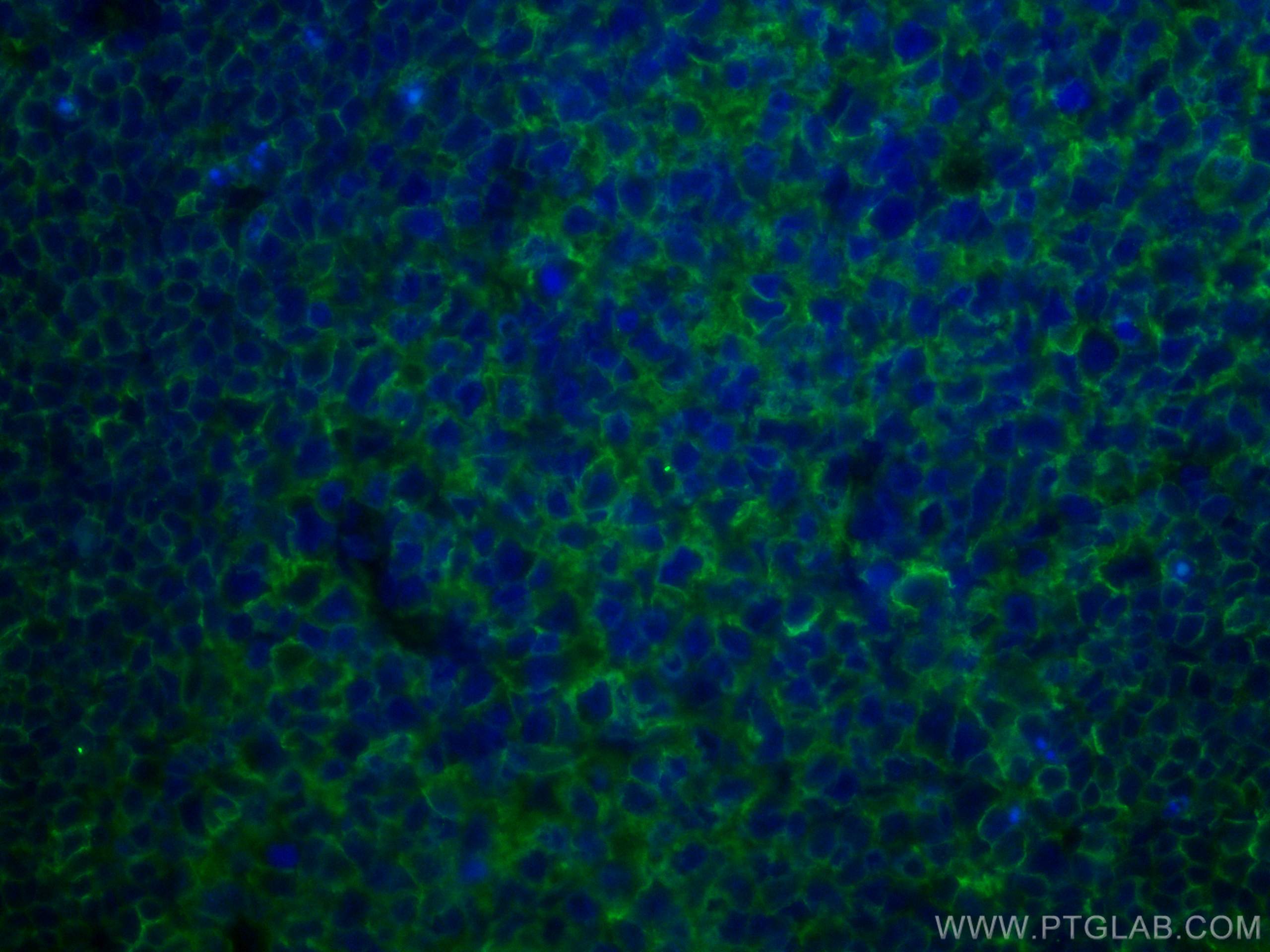 Immunofluorescence (IF) / fluorescent staining of human tonsillitis tissue using HLA-E Monoclonal antibody (66530-1-Ig)