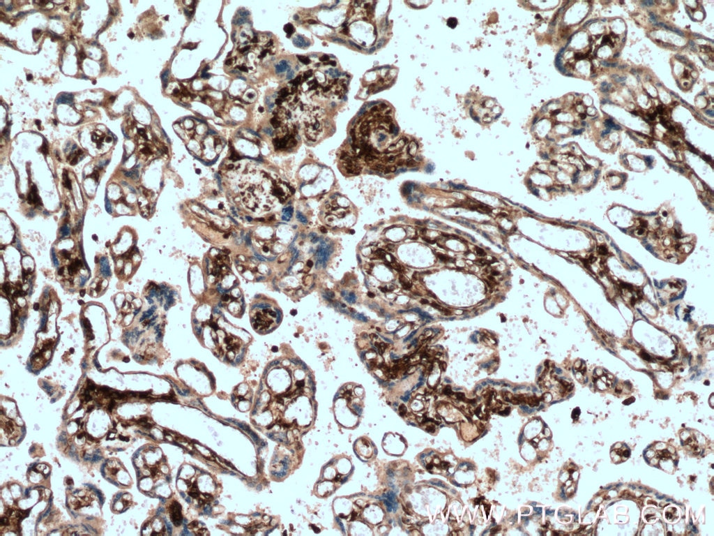 Immunohistochemistry (IHC) staining of human placenta tissue using HLA-E Monoclonal antibody (66530-1-Ig)