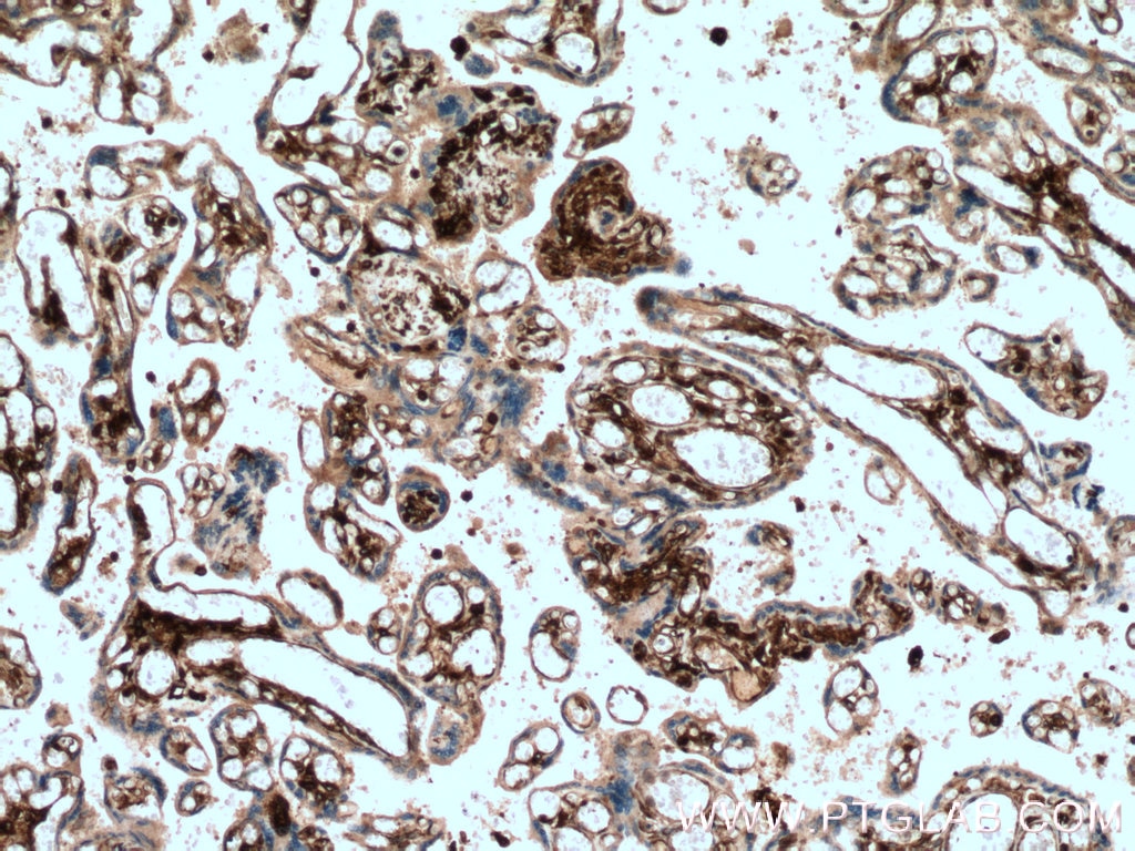 IHC staining of human placenta using 66530-1-Ig