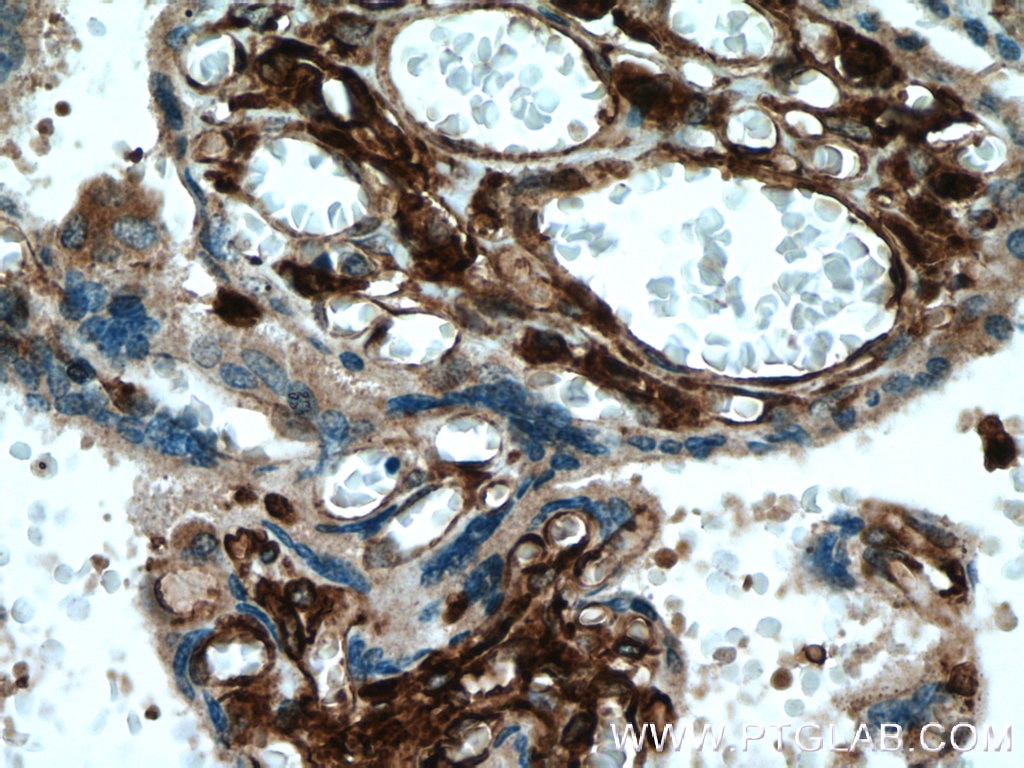 Immunohistochemistry (IHC) staining of human placenta tissue using HLA-E Monoclonal antibody (66530-1-Ig)