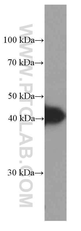 Western Blot (WB) analysis of Jurkat cells using HLA-E Monoclonal antibody (66530-1-Ig)