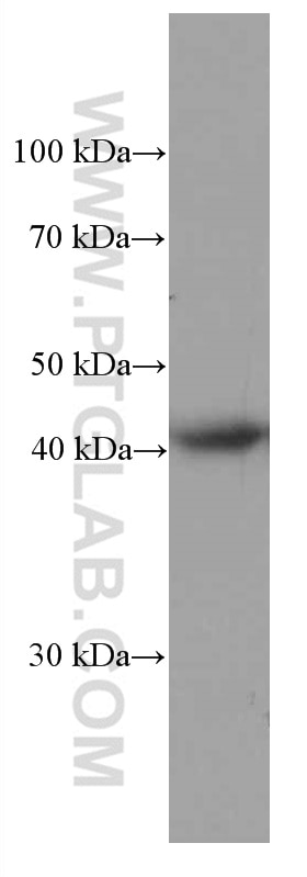 Western Blot (WB) analysis of HUVEC cells using HLA-E Monoclonal antibody (66530-1-Ig)