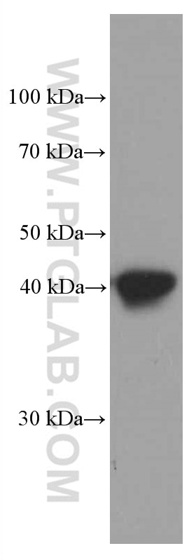 Western Blot (WB) analysis of human placenta tissue using HLA-E Monoclonal antibody (66530-1-Ig)