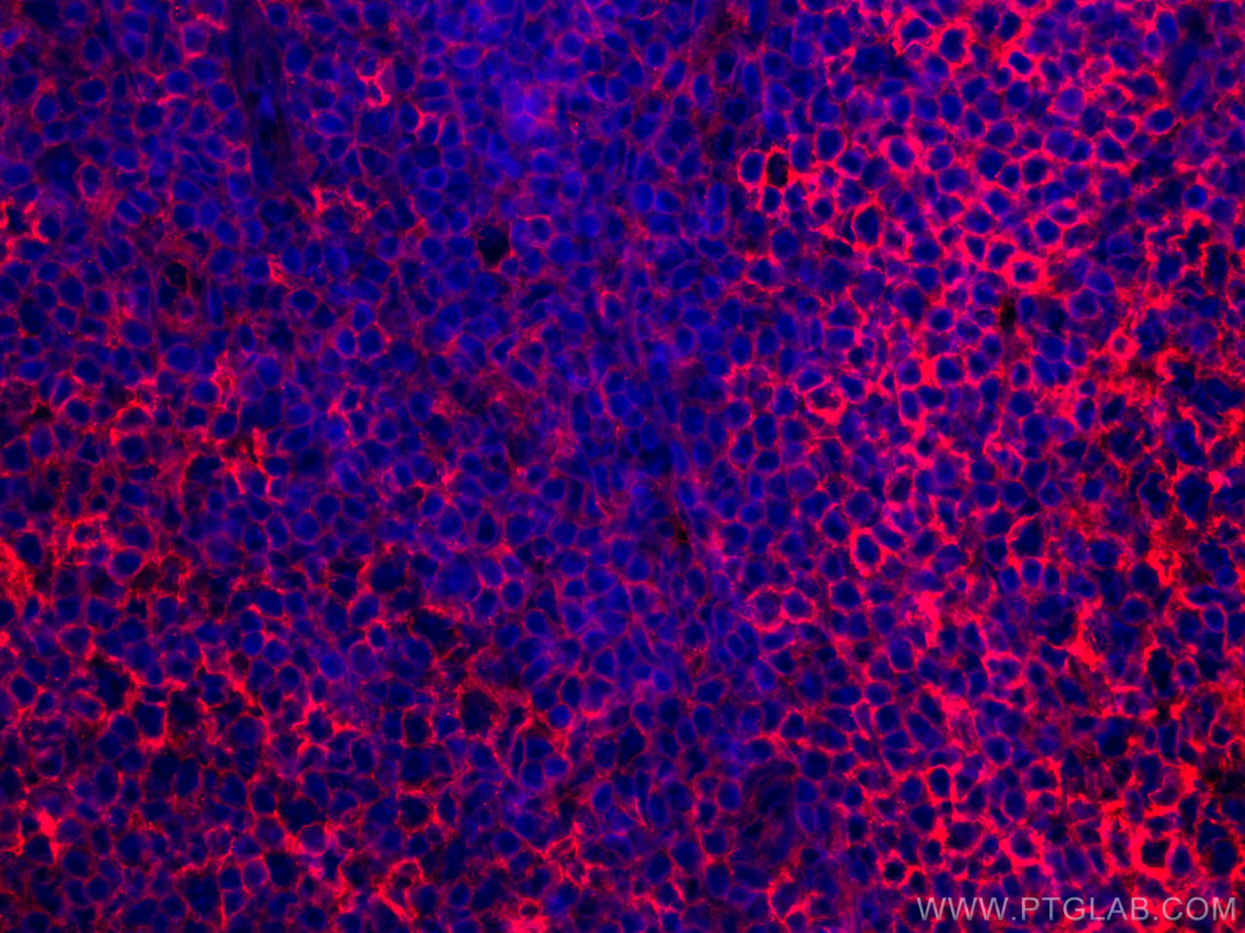 Immunofluorescence (IF) / fluorescent staining of human tonsillitis tissue using CoraLite®594-conjugated HLA-E Monoclonal antibody (CL594-66530)