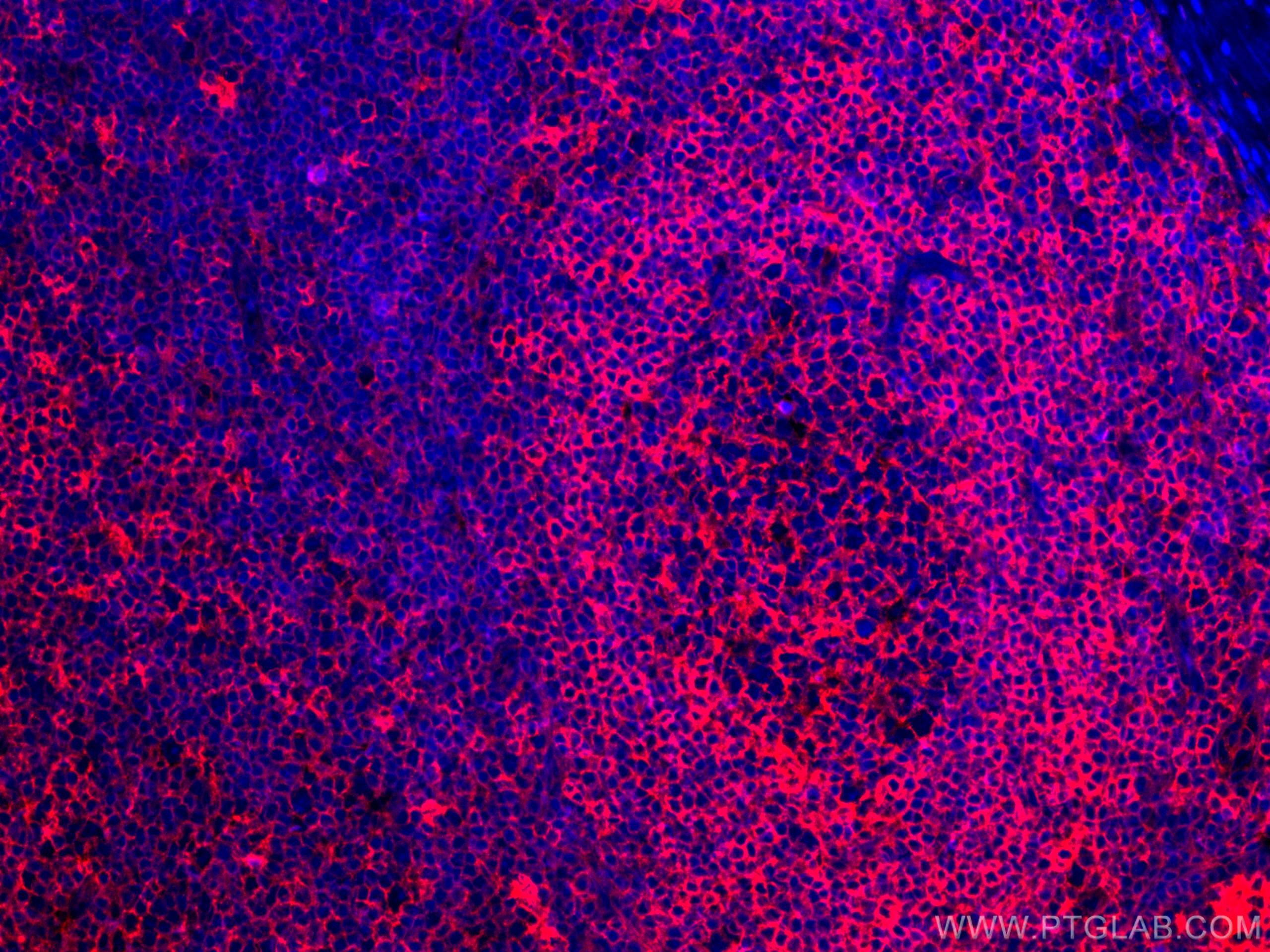 Immunofluorescence (IF) / fluorescent staining of human tonsillitis tissue using CoraLite®594-conjugated HLA-E Monoclonal antibody (CL594-66530)