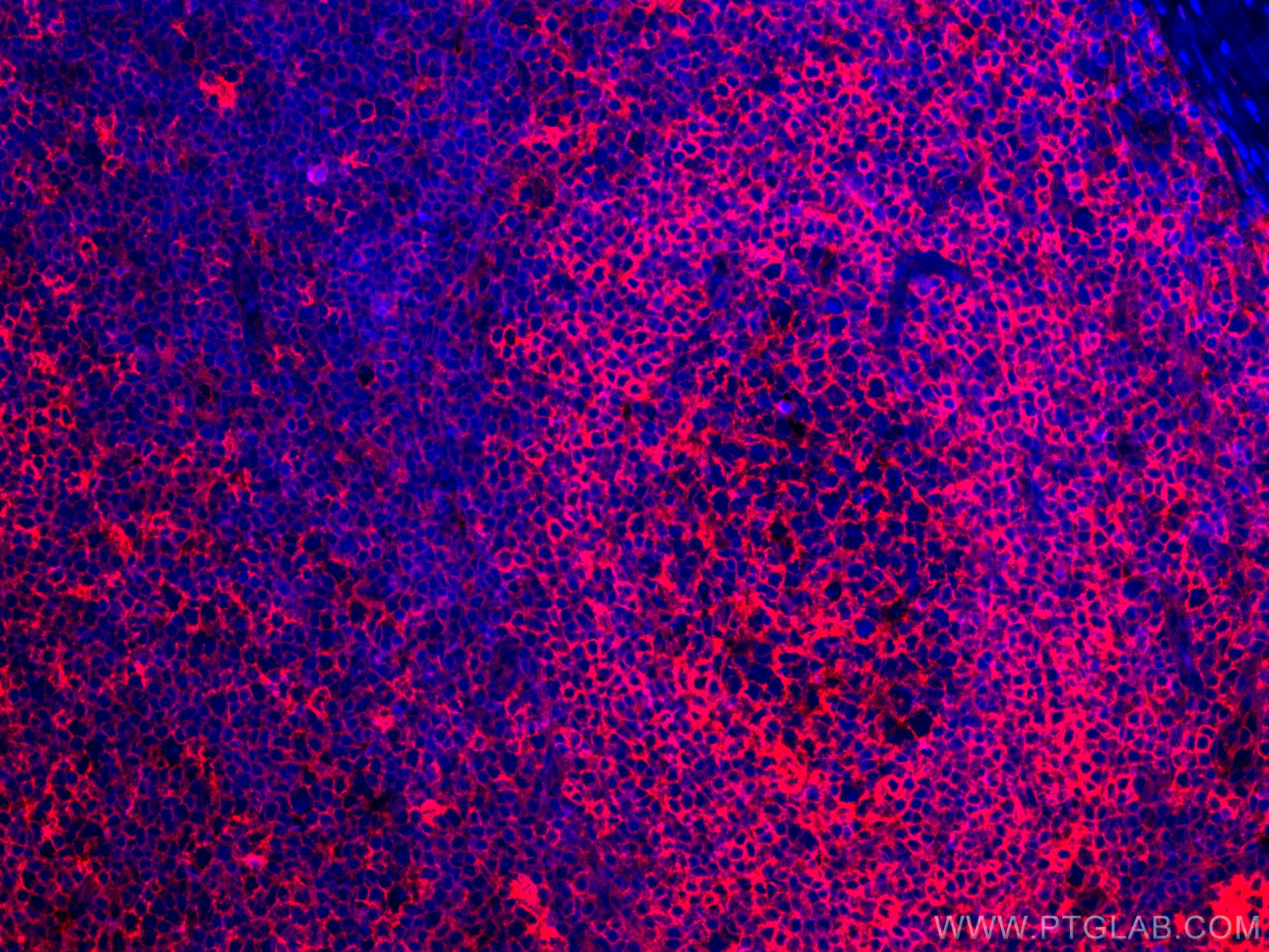 IF Staining of human tonsillitis using CL594-66530