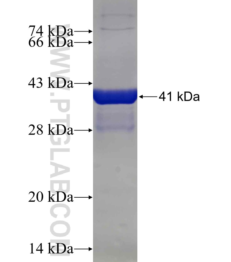 HLA-E fusion protein Ag26581 SDS-PAGE